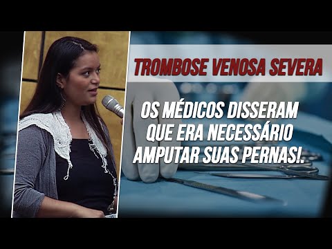 Ela ia ter que amputar as pernas! - Jejum Coletivo