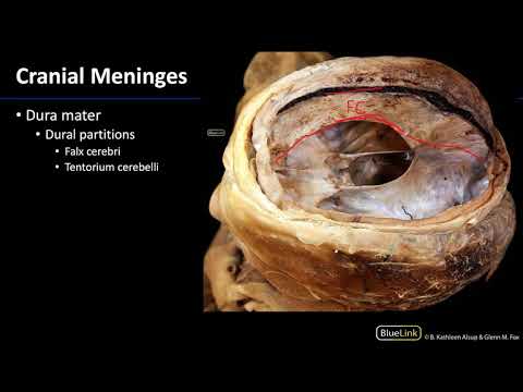 Cranial Cavity and Brain - Meninges and Dural Partitions
