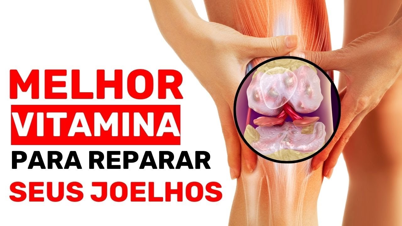 TOP 3 Vitaminas para Reparar Articulações Dolorosas que Realmente Funcionam!
