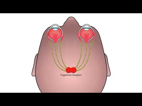 The neurolens® System