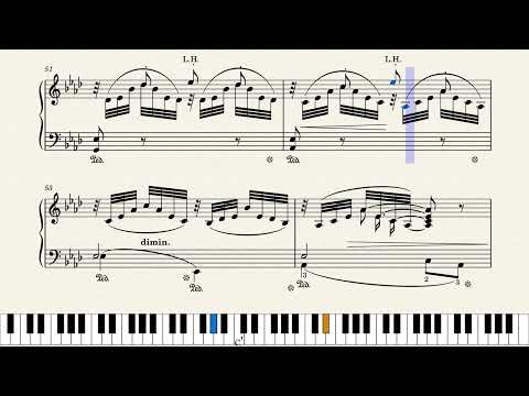 Blätterrauschen (Rustling Leaves) – Gustav Lange, Op. 294