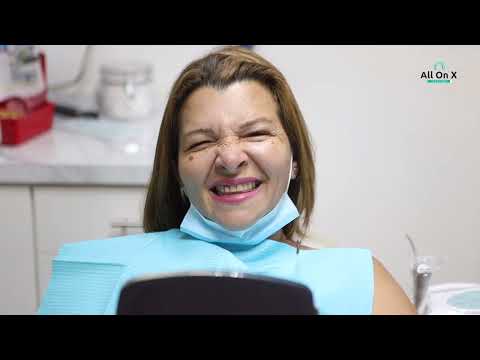 Transform Your Smile at All on X Dental Studio – Full Mouth Restorations in Los Algodones, Mexico