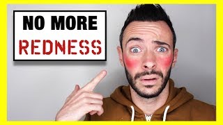 How to GET RID of FACIAL REDNESS, ROSACEA, & DRY SKIN | Does It Work?