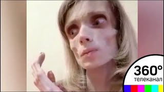 У страдающей анорексией Кристины Карягиной появился шанс на спасение