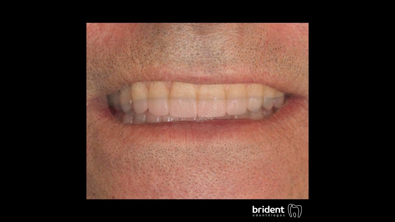 Guillermo Moreno Fragoso-73