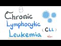 Chronic Lymphocytic Leukemia CLL Etiology Risk Factors Symptoms Signs Diagnosis Treatment