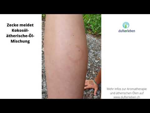 Zecke meidet Kokosöl/ätherisches Öl