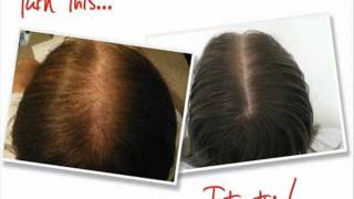 Super Potent Jamaican Black Castor Oil For Hair Loss