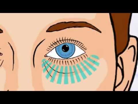 comment guerir les poches des yeux