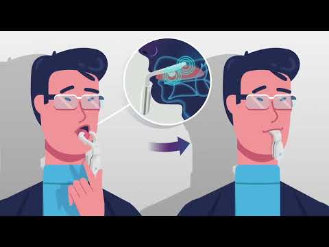 Quick Start Guide for eXciteOSA