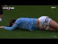 Jack Grealish Soccer Nutshot Manchester City Vs Newcastle 28 08 2024 Pelotazo En Los Huevos