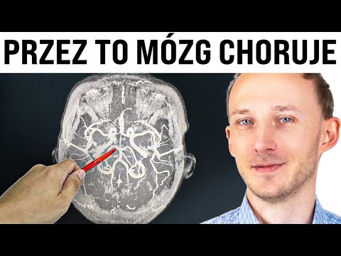 Nawyki niszczące zdrowie mózgu. NR 6 daje do myślenia