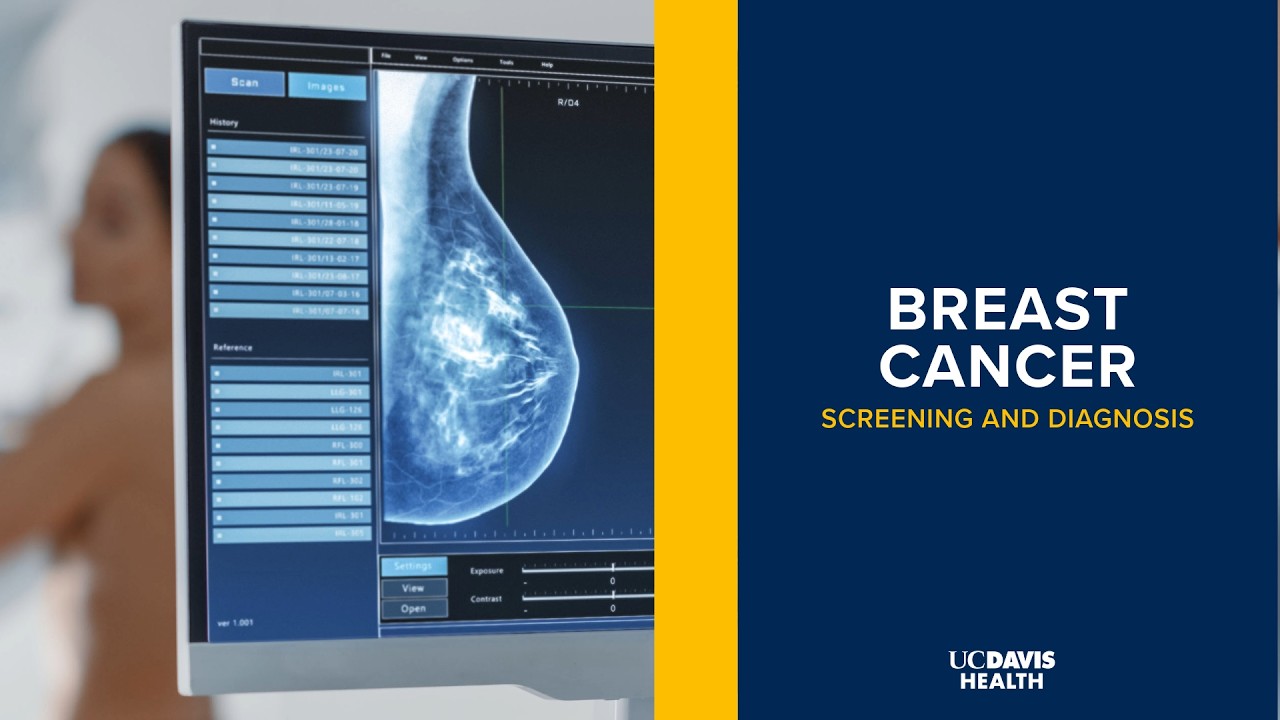 Thumbnail preview of Breast Cancer Screening: Mammograms, Risk Factors and Early Detection | UC Davis Health