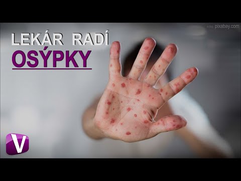 download lagu mp3 mp4 Osýpky, download lagu Osýpky gratis, unduh video klip Osýpky