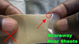 ✅  How To Use Scaraway Silicone Scar Sheets Review