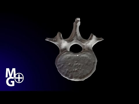 Vertebra lombara L3 (Prezentare 3D- Anatomie)