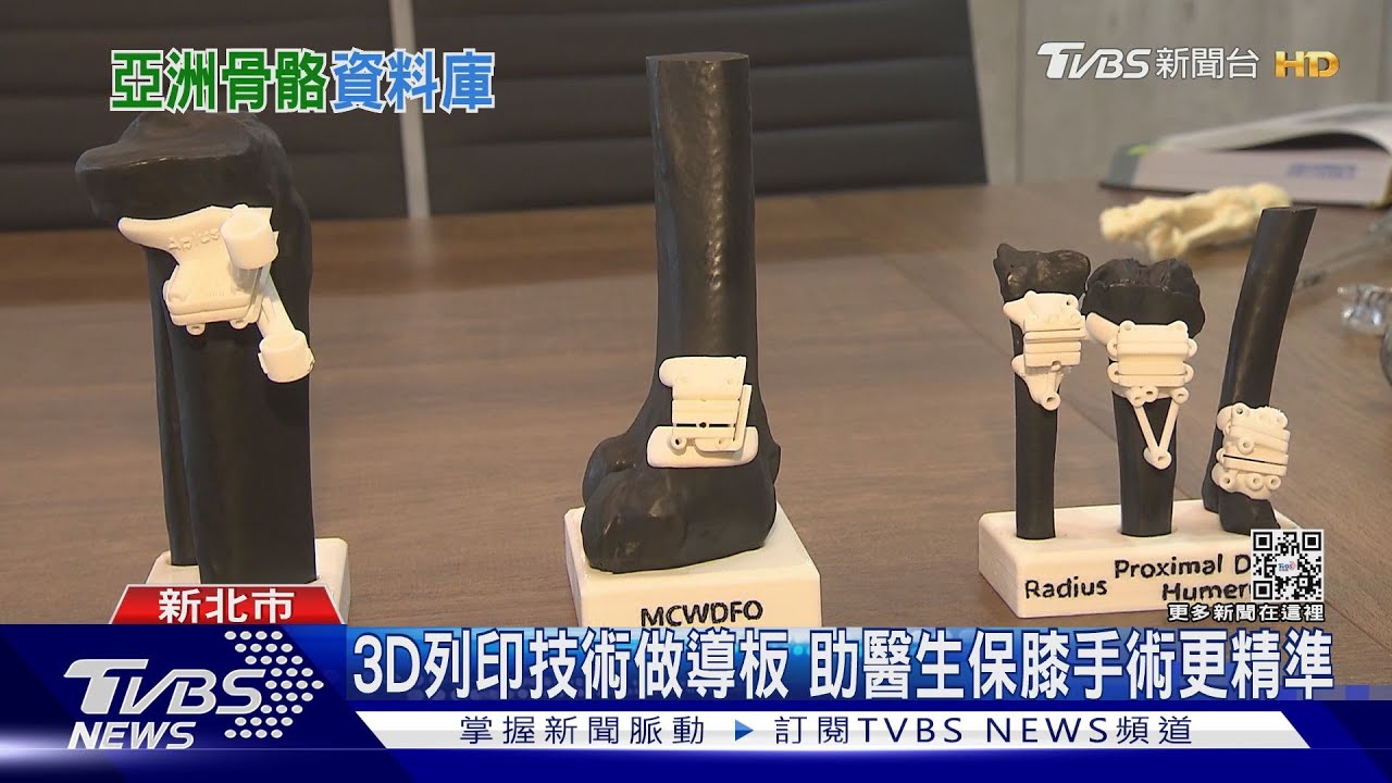 膝蓋痛就要換人工關節嗎？　台廠創「這技術」保膝