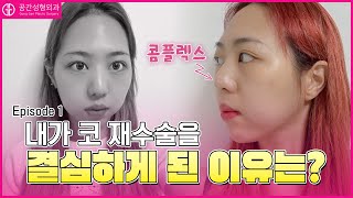 코 재수술을 다시한번 결심하게 된 이유는?｜#코재수술잘하는곳 #코재수술 #코성형