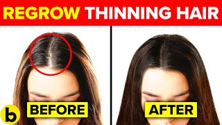 13 Ways To Regrow Your Hair Naturally And Forget About Bald Spots