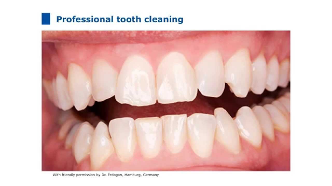 Product Training Flairesse: Professional prophylaxis in the dental practice