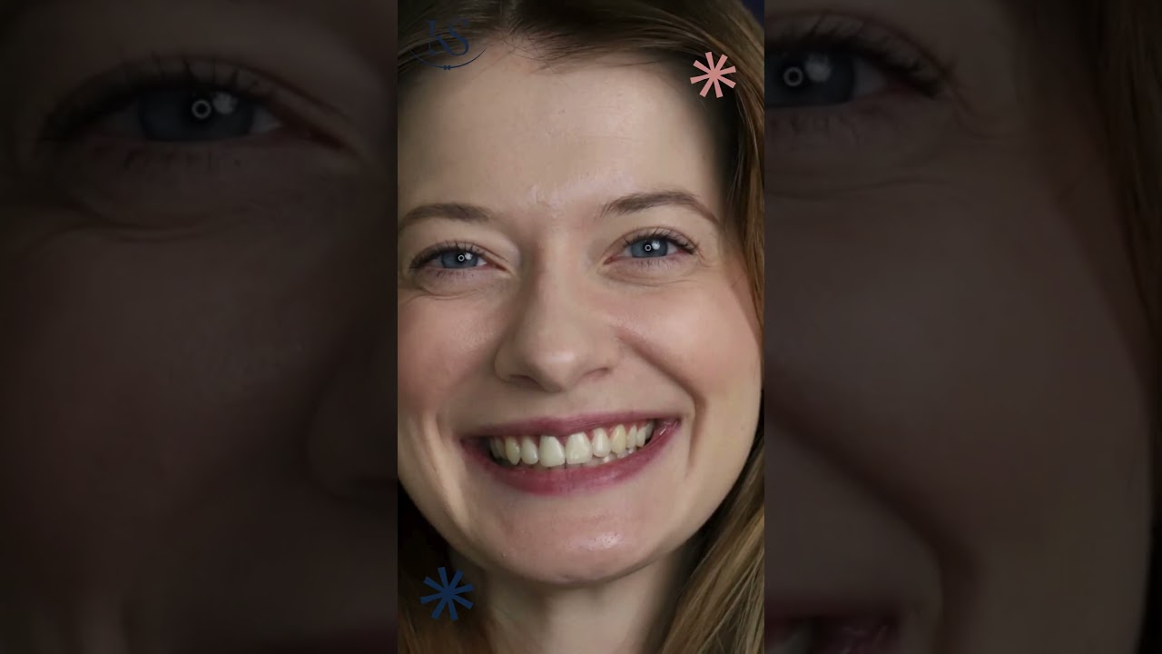 ESZTER MOSOLY ÁTALAKULÁSA - előtte / utána