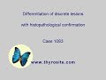 Differentiation Of Discrete Lesions Case 1083