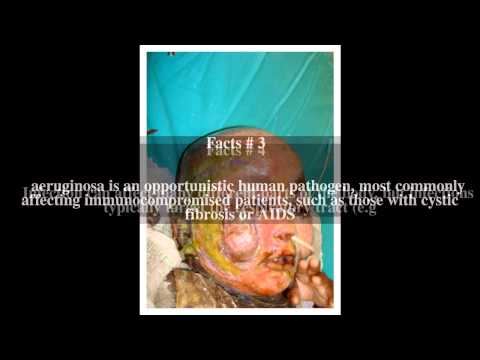 Paggamot ng striae kuko Kung lamang lotserilom lunas kuko halamang-singaw