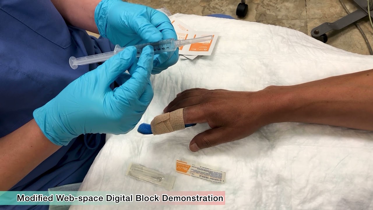 Digital Blocks - A Thorough Review - EB Medicine