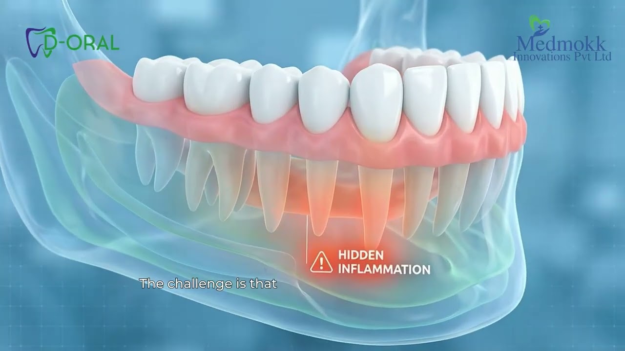 Rheumatoid Arthritis | Medmokk
