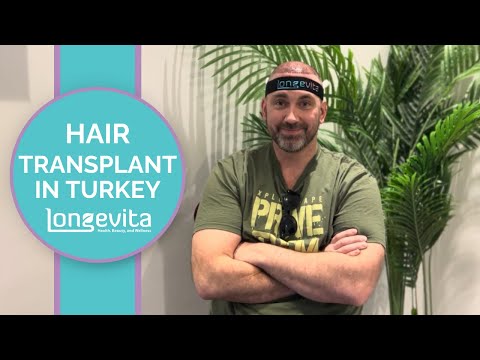 "I've had some thinning hair on the top..." | Hair Transplant Turkey