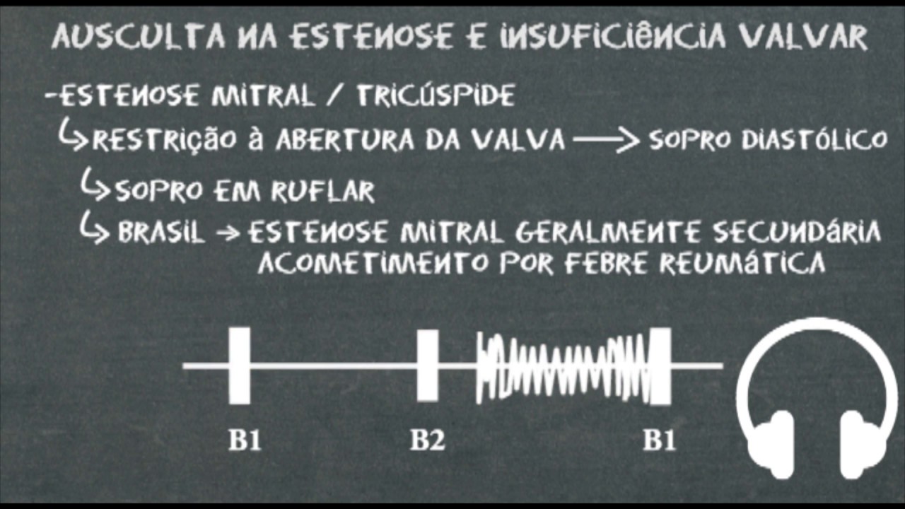 Ausculta cardíaca na estenose e insuficiencia valvares