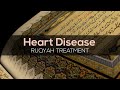 Heart Disease Ruqyah Treatment Ruqyah For Heart Problems