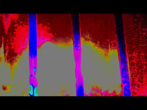 echolyte 530 bpm and 72 bpm