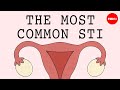 The most common STI in the world - Emma Bryce