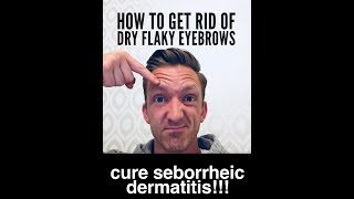 How To Get Rid Of Dry Flaky Eyebrows Seborrheic dermatitis Dandruff WORKS