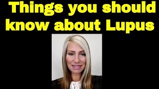 LUPUS DISEASE EXPLAINED: Symptoms, Treatments, Causes, Stories, Facts, etc.