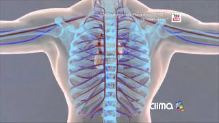 Muerte súbita por frío