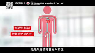 Re: [問卦] 心臟支架手術會很危險嗎