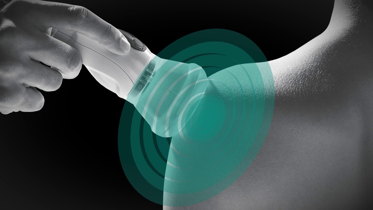 ASAlaser | MiS - MLS®