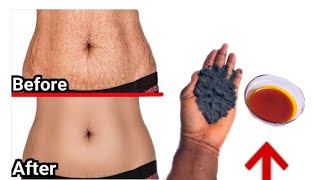 Red Oil & Ash To Remove  All Your Stretch Marks / Grandma’s Best Remedy For Stretch Marks