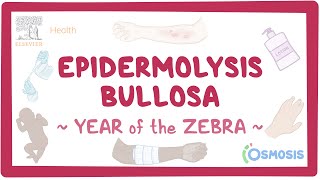 Epidermolysis Bullosa