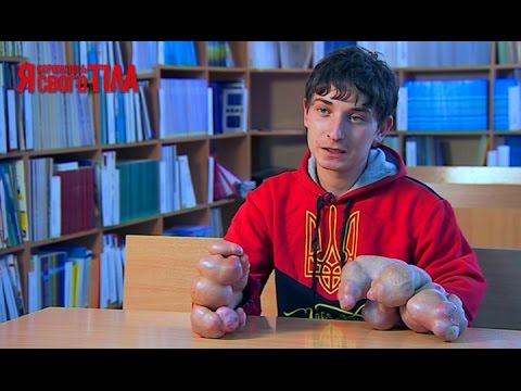 Санатории в белокурихе лечение грыжи позвоночника Болит низ живота слева и отдает в поясницу пучит
