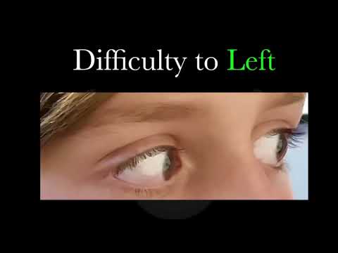 Pro Goalie Vision Training Program