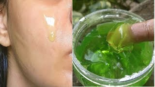 OMG SHOCKING i apply Aloevera Gel every night & look what happened to my face Crystal Clear Skin
