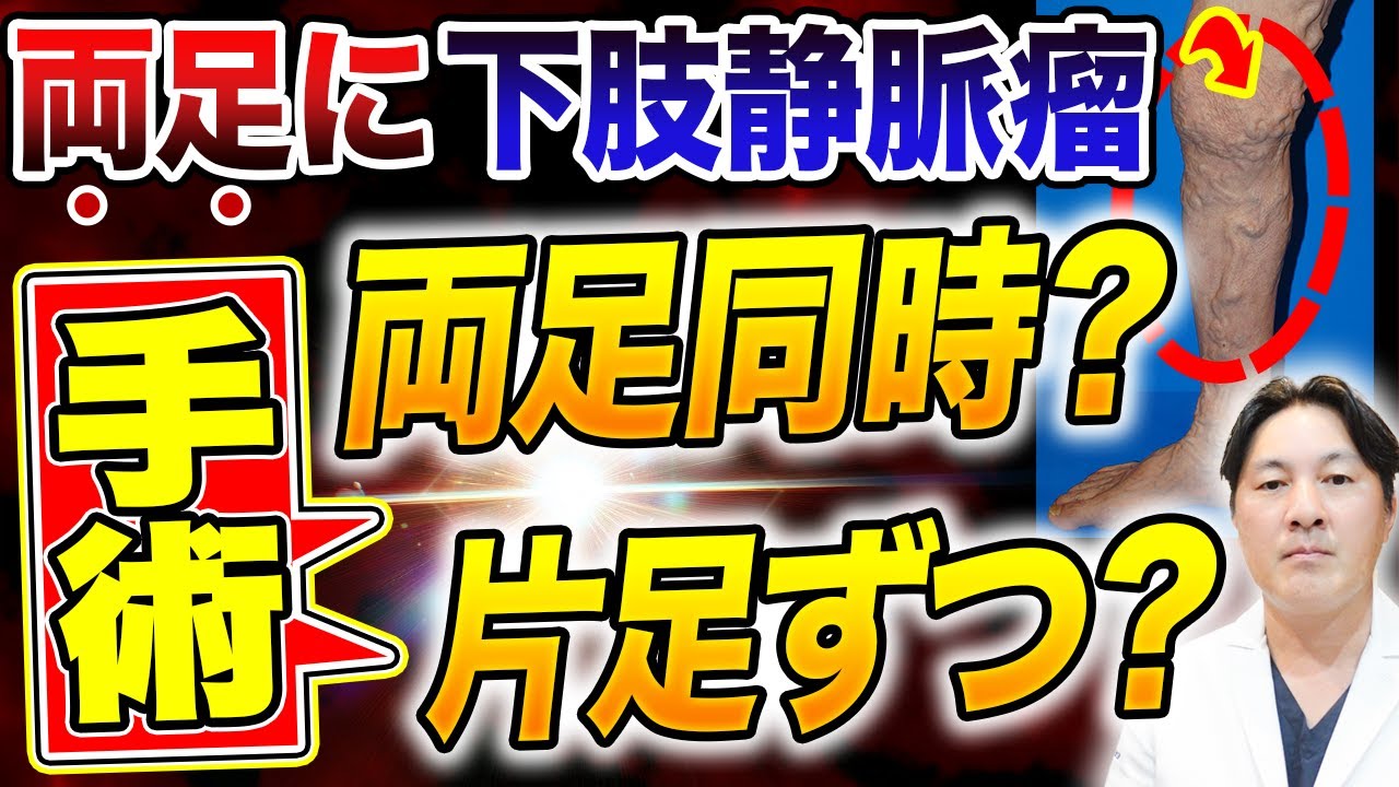 両足に静脈瘤がある場合、両足同時に手術すべきか？それとも片足ずつが良いのか？