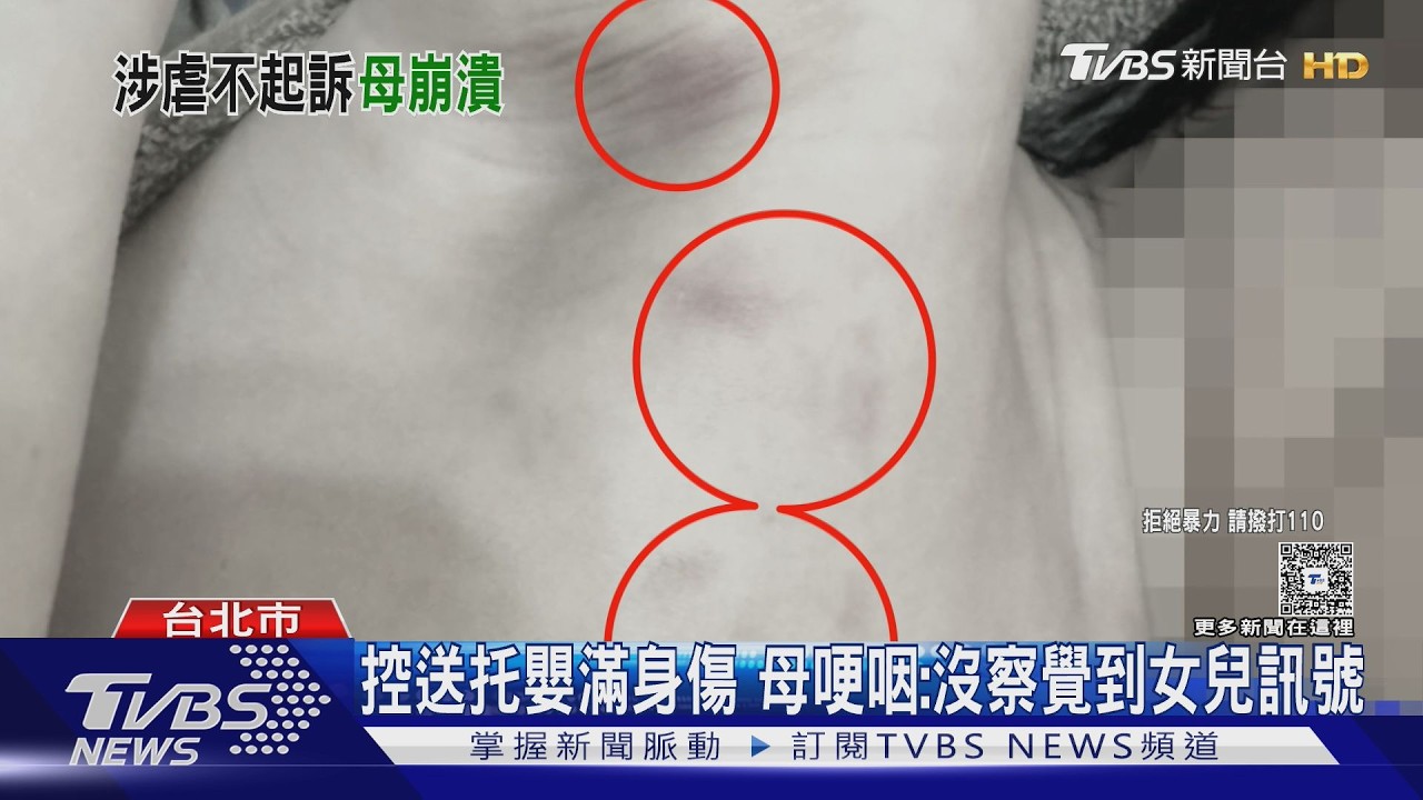 1歲女送托嬰「全身傷」控遭粗暴對待　母哽咽：哭喊1個月不要上學