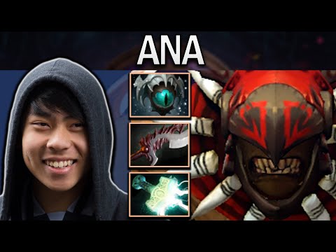 Bloodseeker Dota 2 Gameplay Ana with 20 Kills - Basher