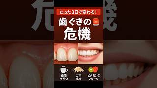 #歯ぐきケア  #歯周病予防  #健康習慣  #白湯うがい  #ゴマ健康法  #ビタミンC  #歯ぐきを強くする  #口腔ケア  #日本語ショーツ  #健康豆知識 #健康情報