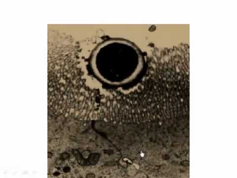 Natural Management of Autoimmune Conditions