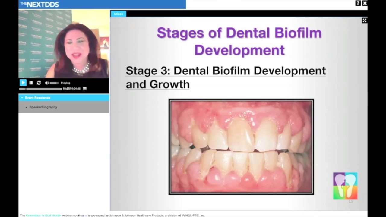 Improving Periodontal Health by Disrupting Dental Plaque Biofilm